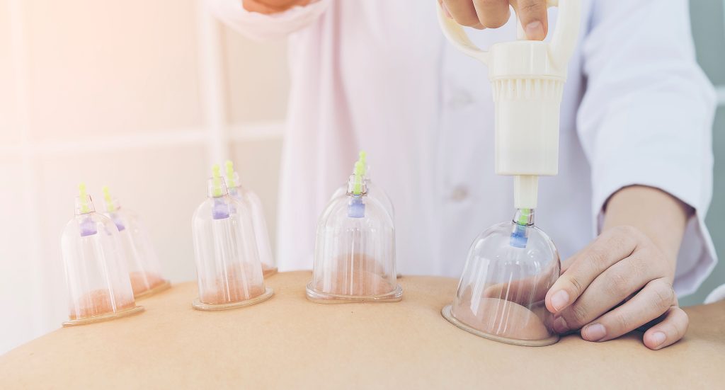 Tcm Humors TCM Cupping Therapy in Singapore | Ma Kuang TCM