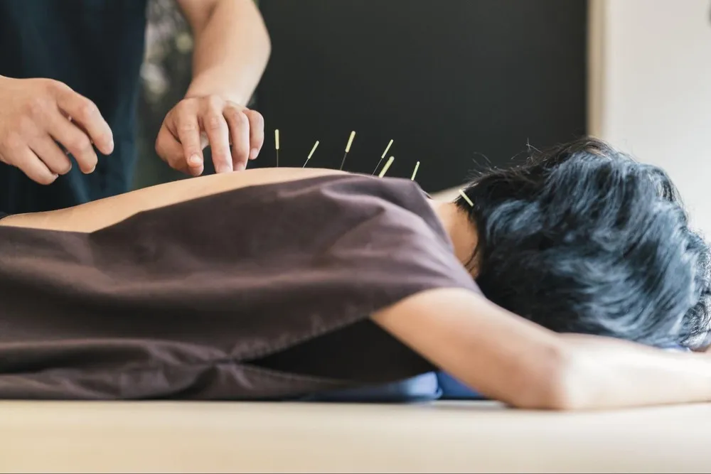 acupuncture for menopause in singapore women