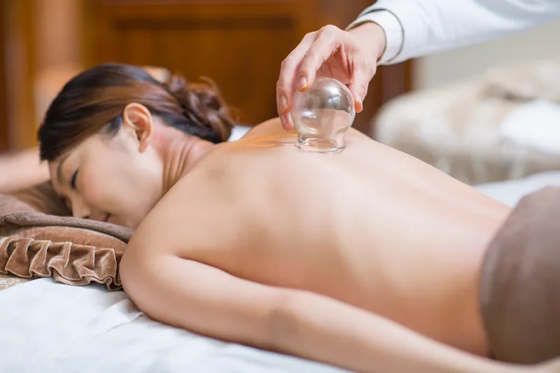 a woman receiving a cupping treatment for her acute back pain